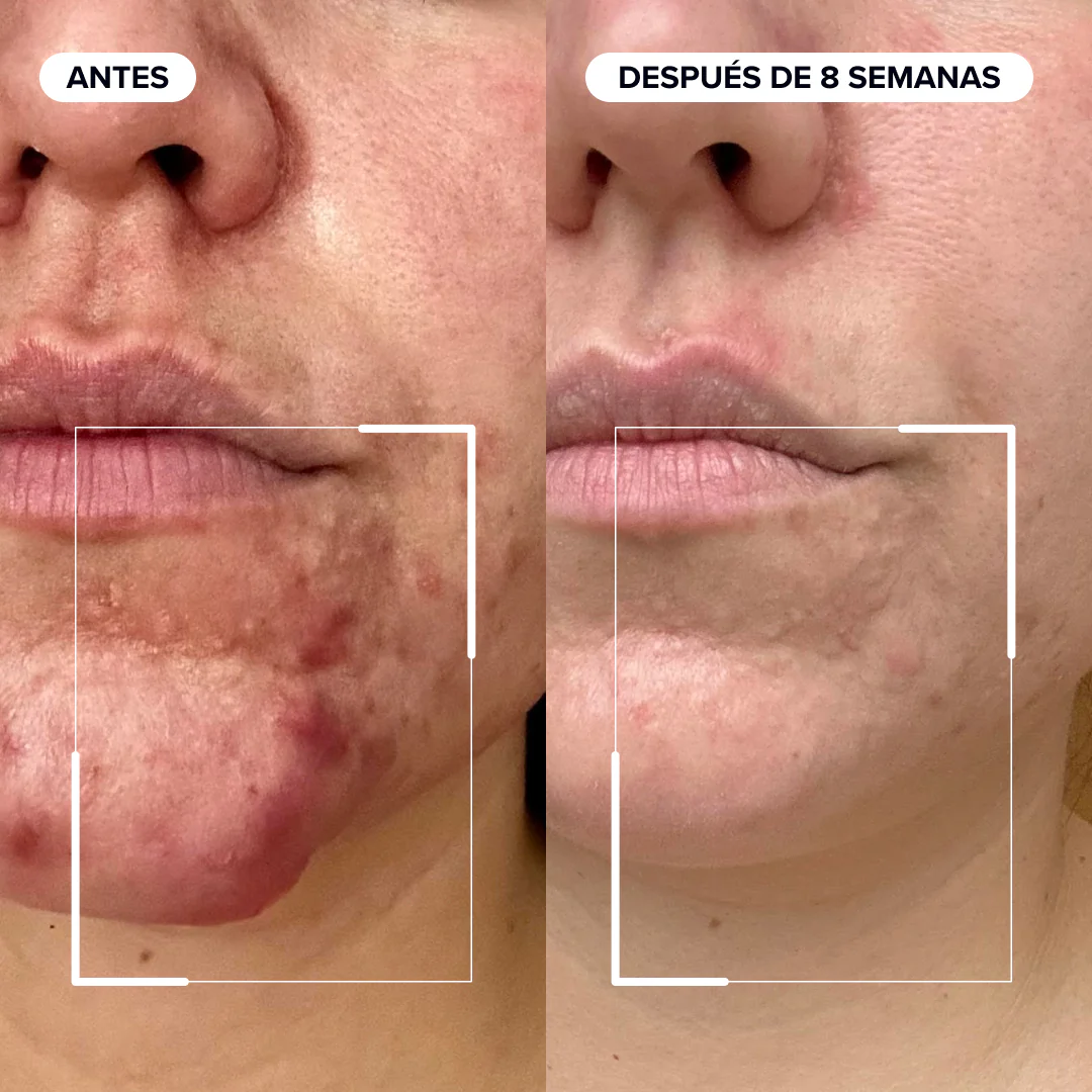 Dermabacs - Image 3