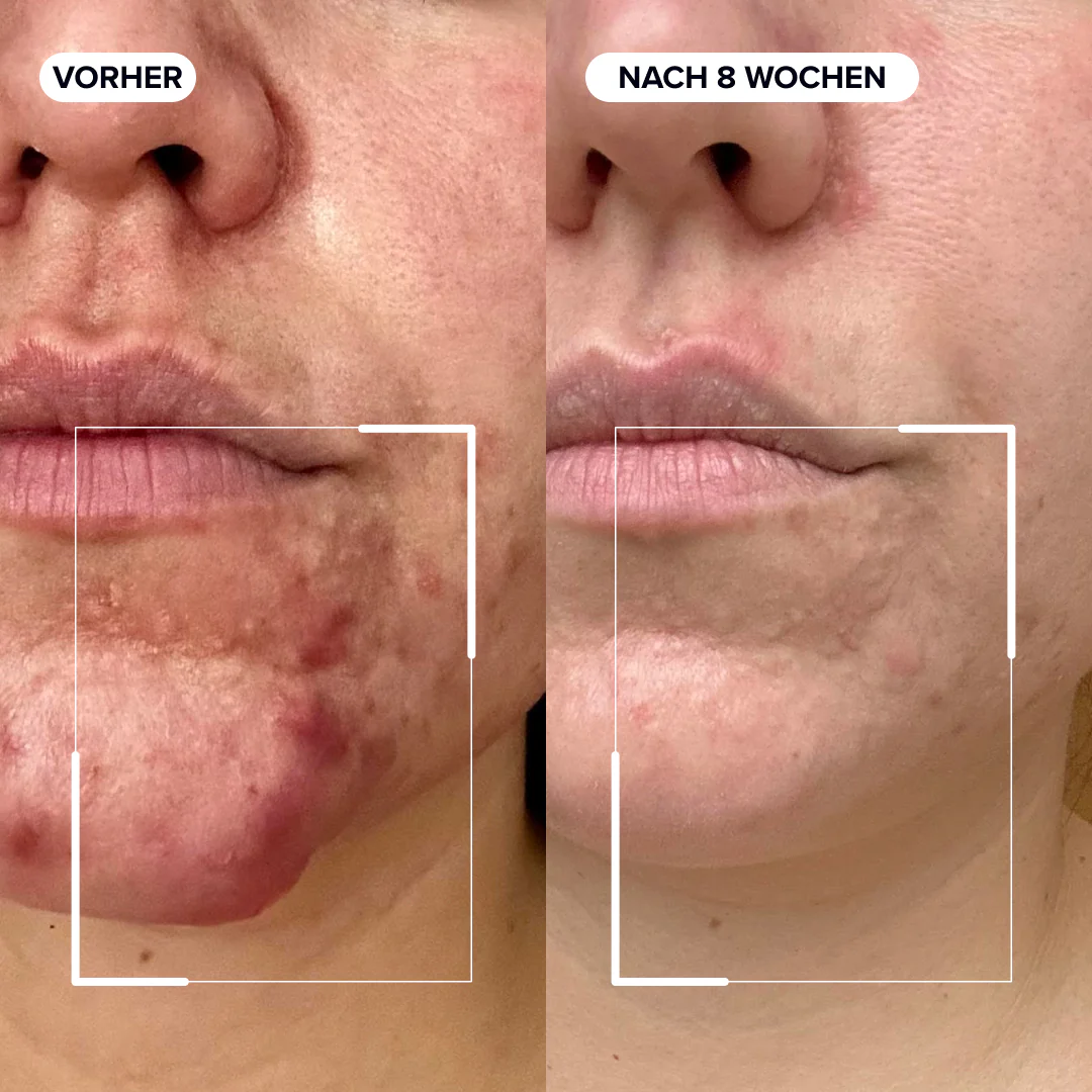Dermabacs® - Image 3